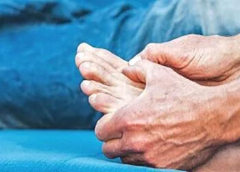 علاقة فقدان الوزن السريع بالنقرس