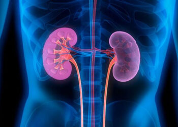 علامات تكشف الإصابة بحصوات الكلى