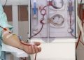 الصحة: تسجيل 7 آلاف مريض وإجراء 239 ألف جلسة غسيل كلوي خلال 3 أشهر