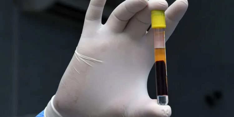 دراسة تكشف مفاجأة عن فيروس كورونا